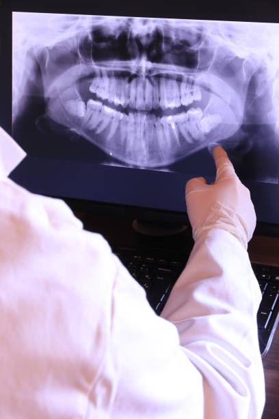 Best Emergency Broken Tooth Repair in Berkeley Lake, GA