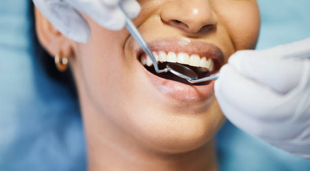 Best Emergency Tooth Extraction in Berkeley Lake, GA